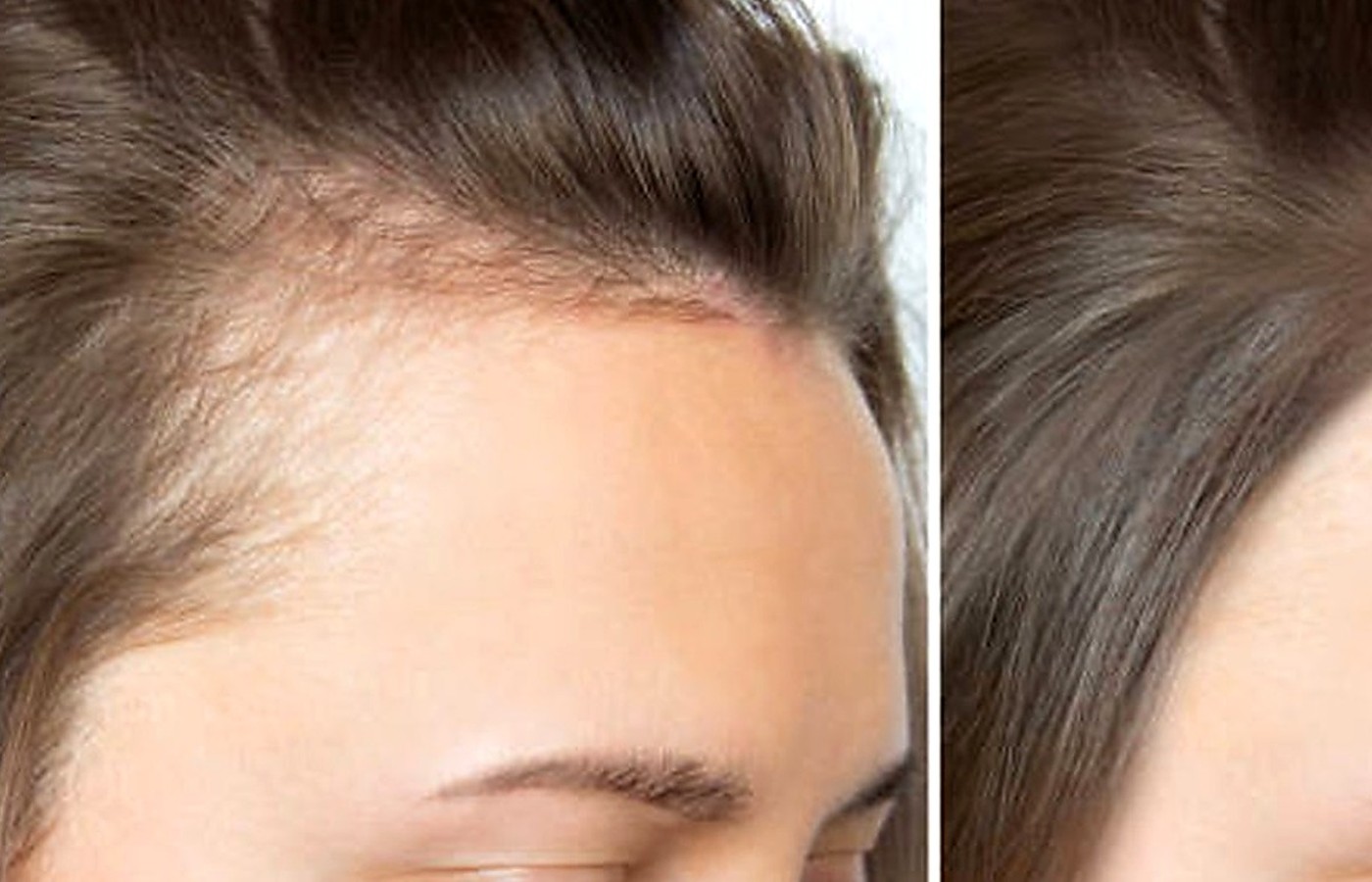Hair Growth health guide